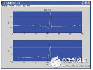 基于生物反饋技術的可穿戴式心電監測系統的設計
