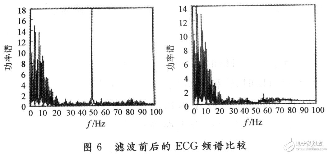  低噪聲便攜式的心電監測儀設計和實現