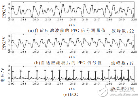 一種基于STM32和PPG技術的腕戴式心率計設計