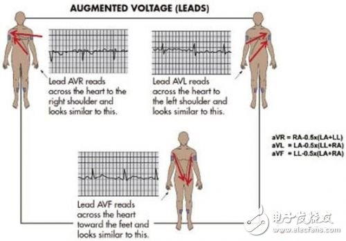 利用ECG AFE簡化病人監護儀設計