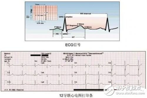 利用ECG AFE簡化病人監(jiān)護(hù)儀設(shè)計