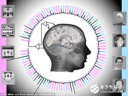 腦電波技術(shù)再上一層樓，讀心準(zhǔn)確率高達(dá)95%